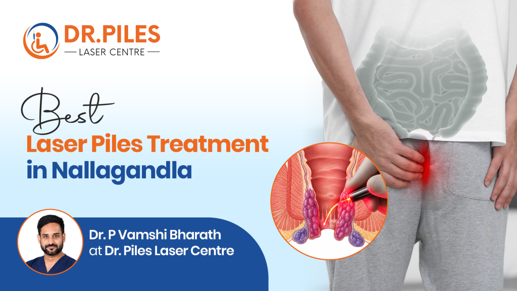 Best Laser Piles Treatment in Nallagandla – Advanced Care by Dr. P Vamshi Bharath at Dr. Laser Piles Centerr